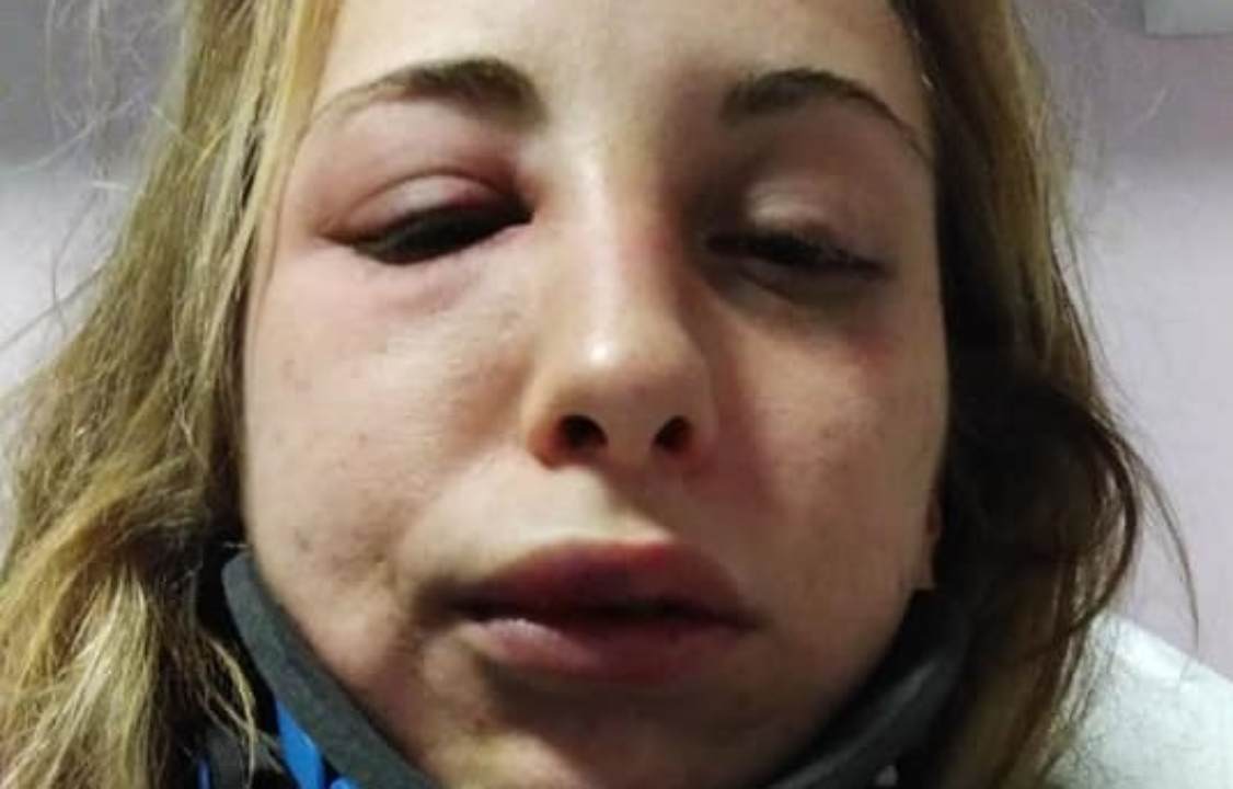 ragazza pubblica foto di un pestaggio