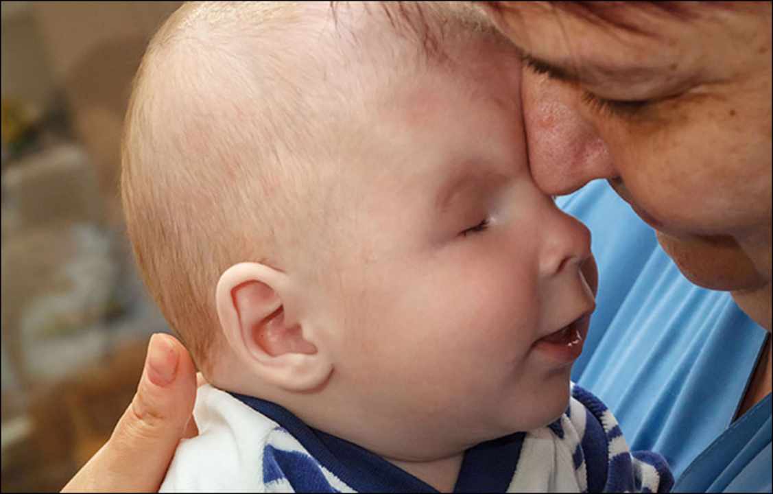 bambino nato senza occhi