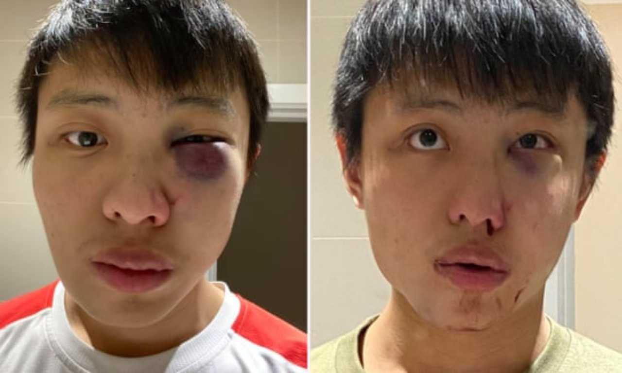 razzismo e coronavirus