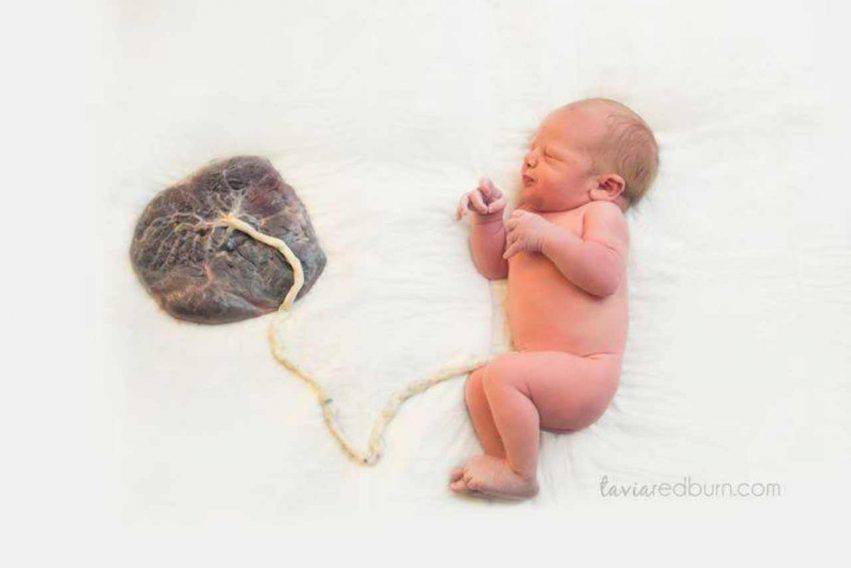 placenta neomamme