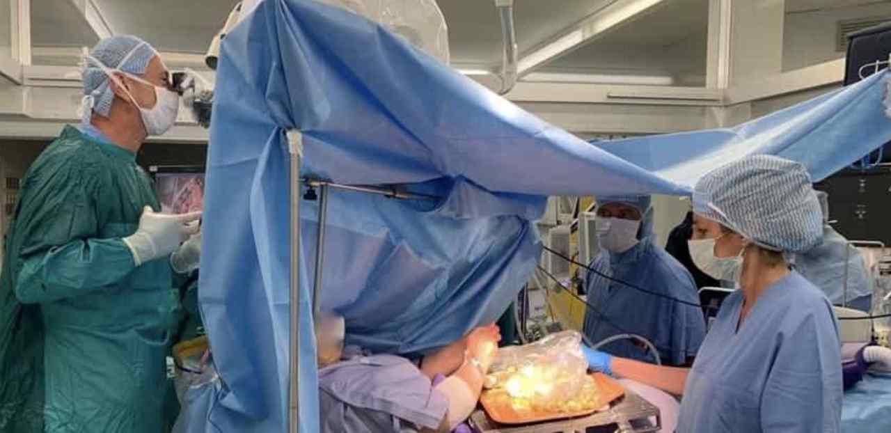 operata al cervello mentre prepara olive all'ascolana