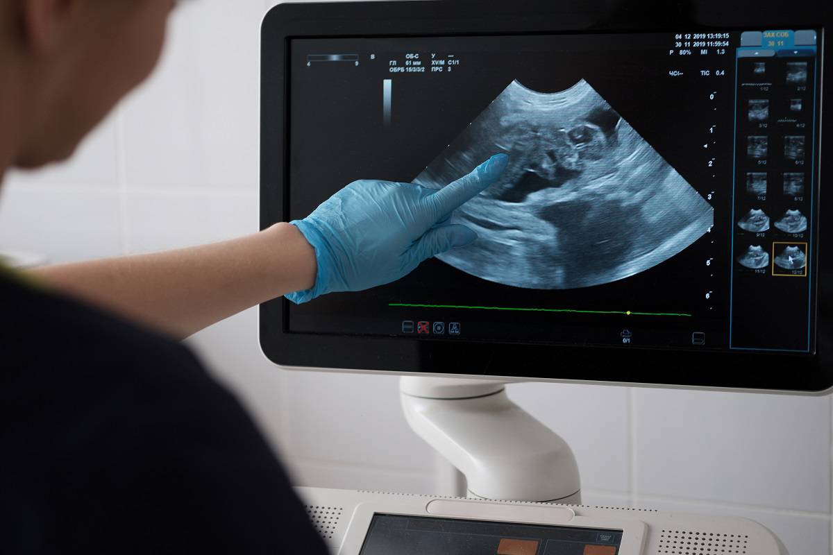 Cribado prenatal o screening de primer trimestre de embarazo. 