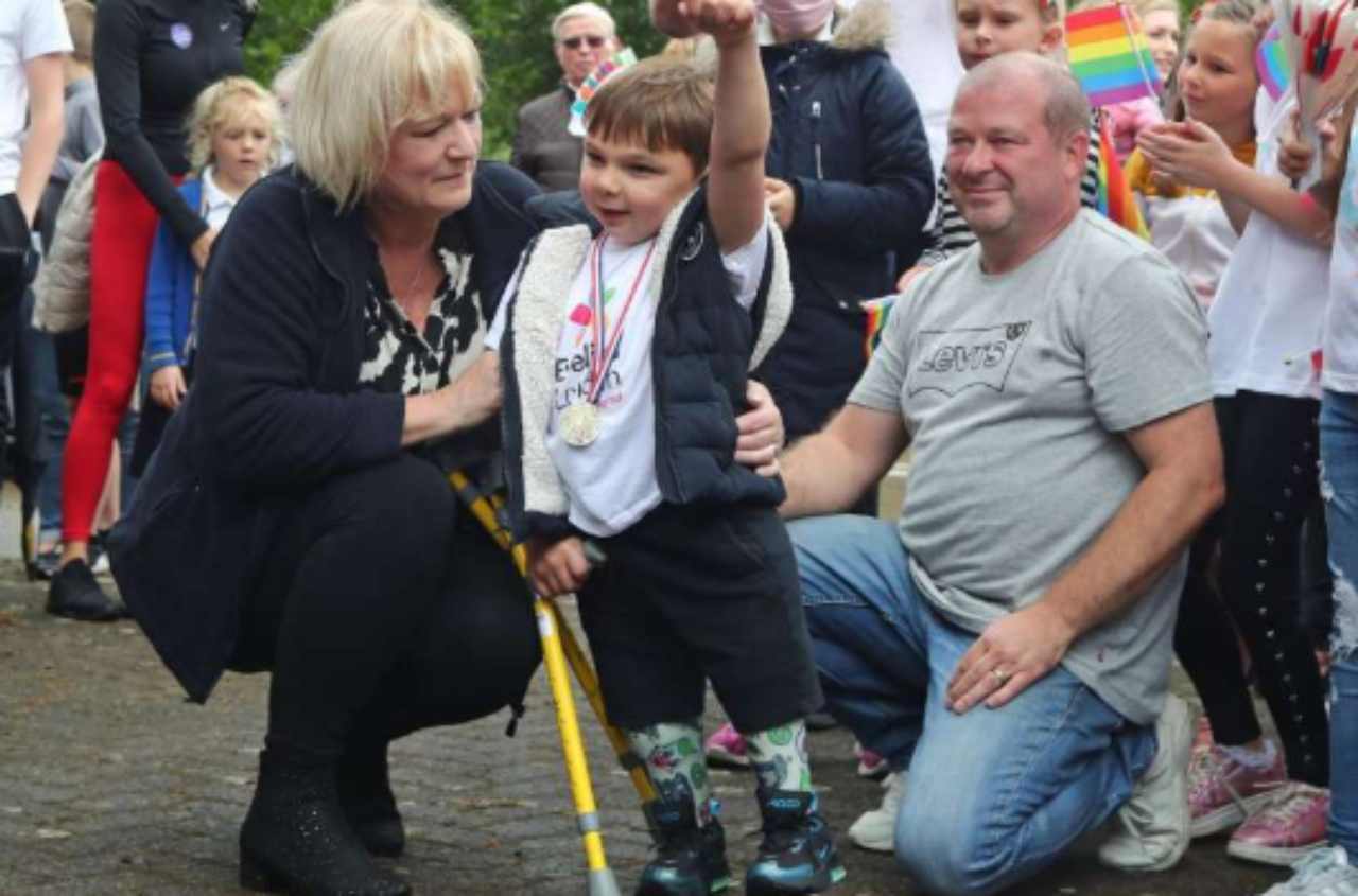 Bambino senza gambe raccolta fondi