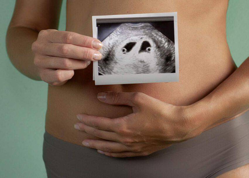 gravidanza gemellare ecografia