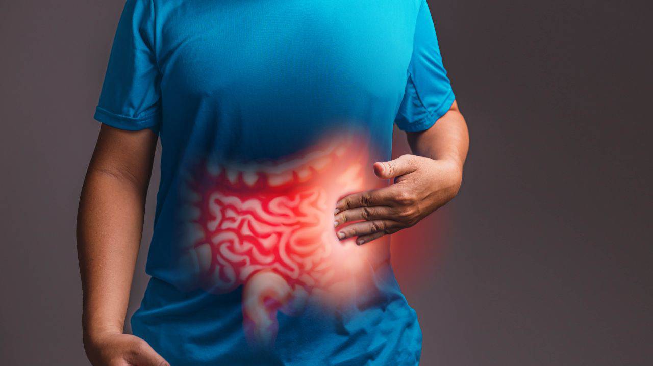 sindrome dell'intestino irritabile