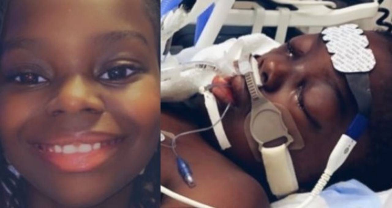 jamison bimbo amputato