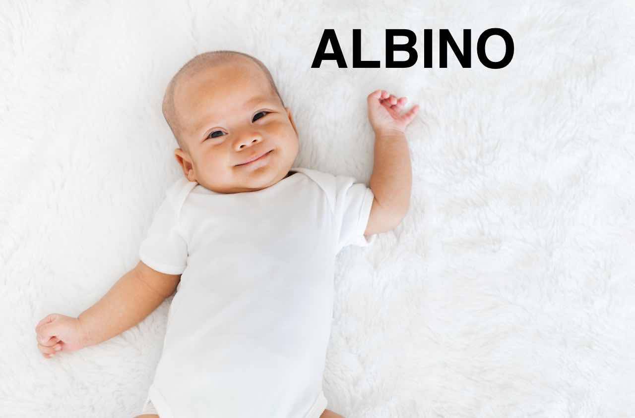 bambino nome albino