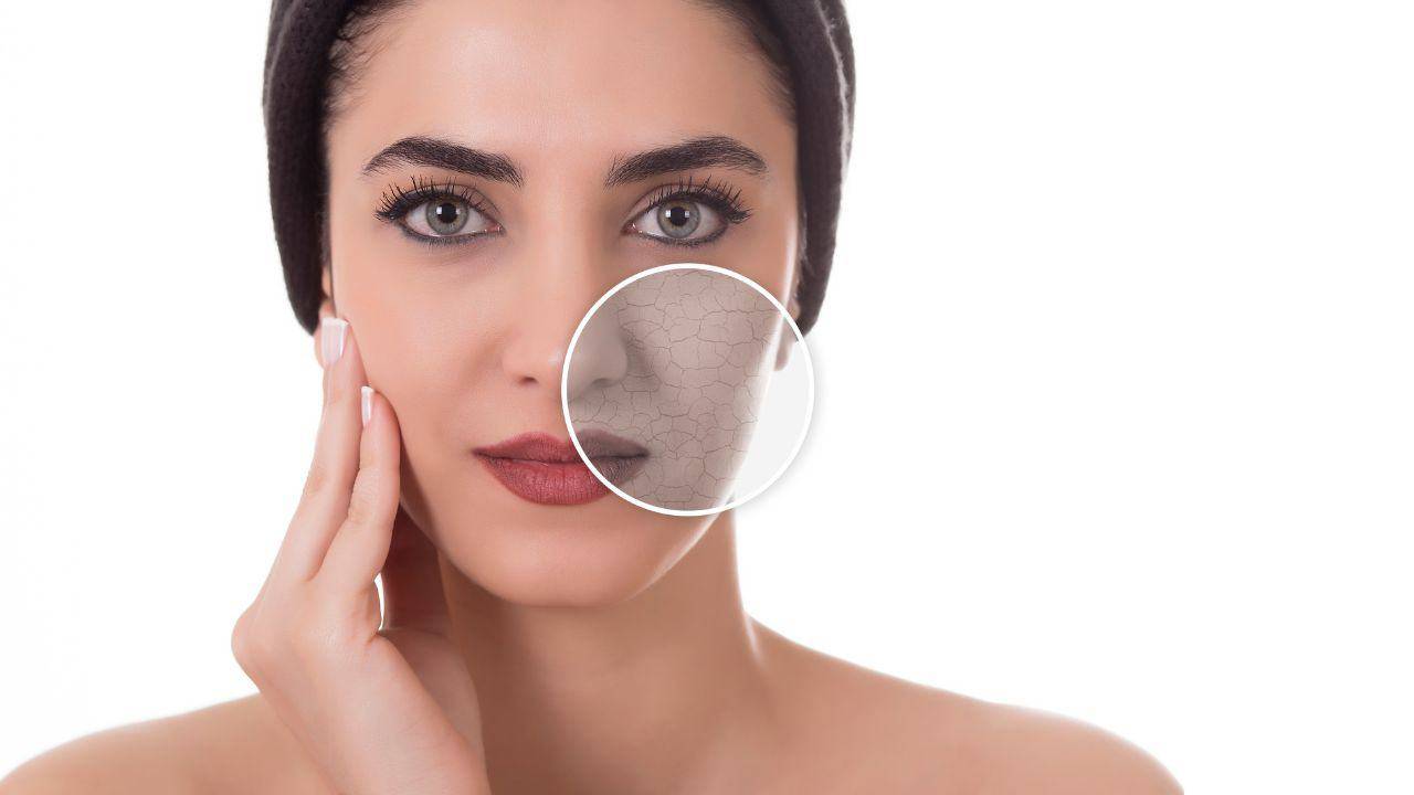 Viso idratato rimedio naturale