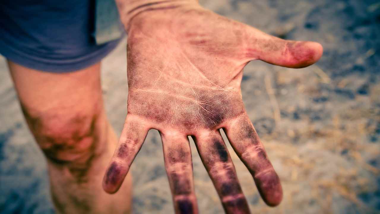 Coisas tão sujas que poucos se lembram de limpar