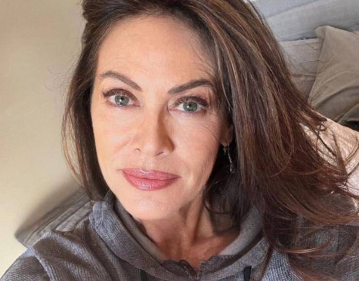 attrice chirurgia estetica