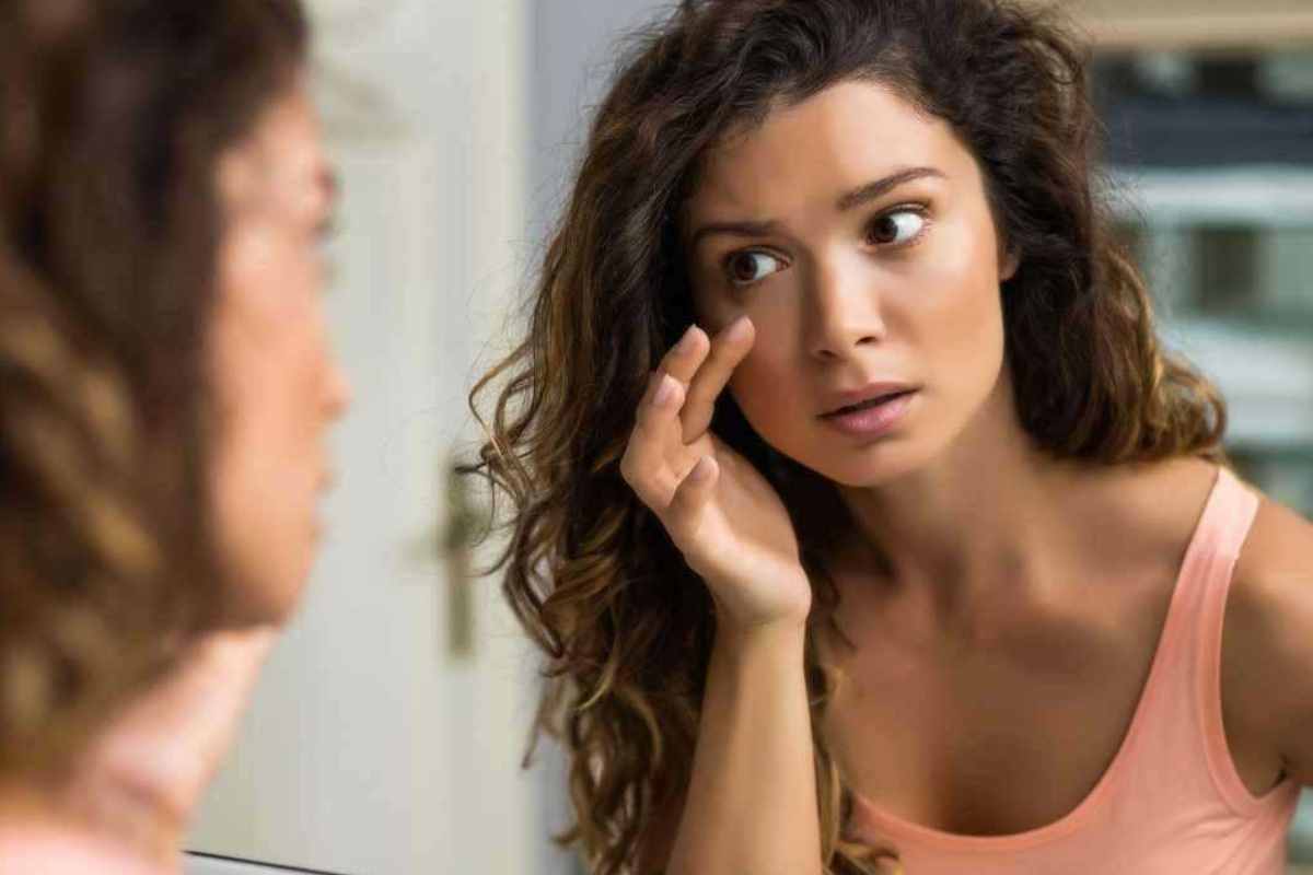 brutte occhiaie viso