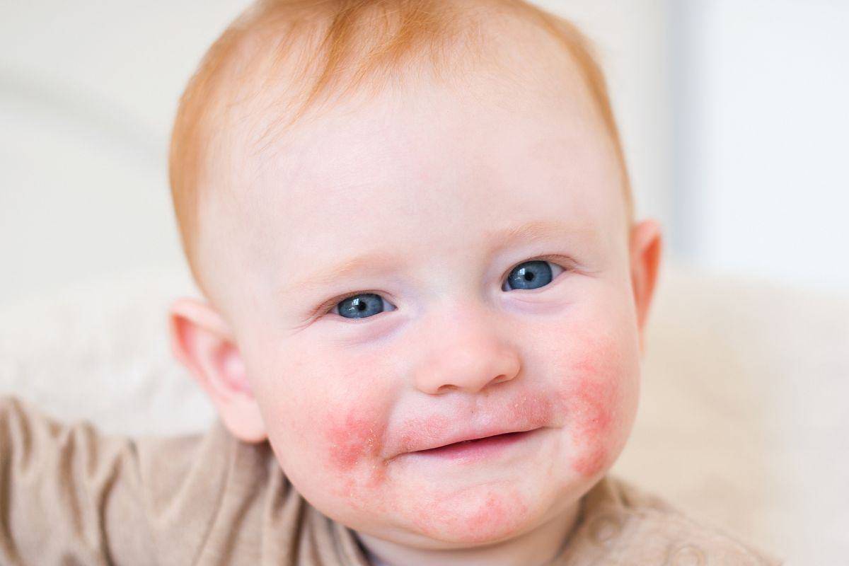 pelle bambino importante sapere