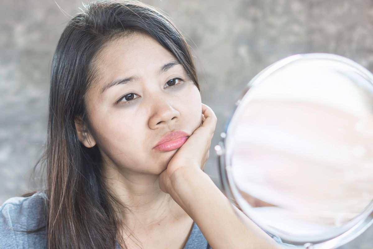 occhiaie rimedio naturale eliminare