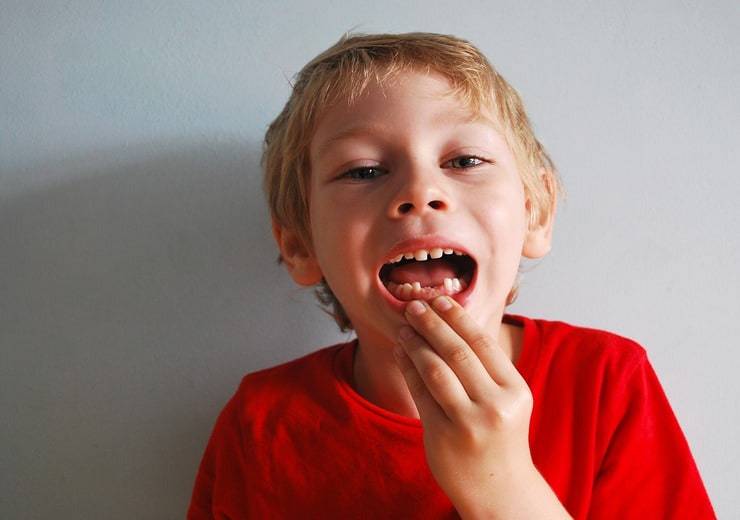 come alleviare il fastidio dei dentini