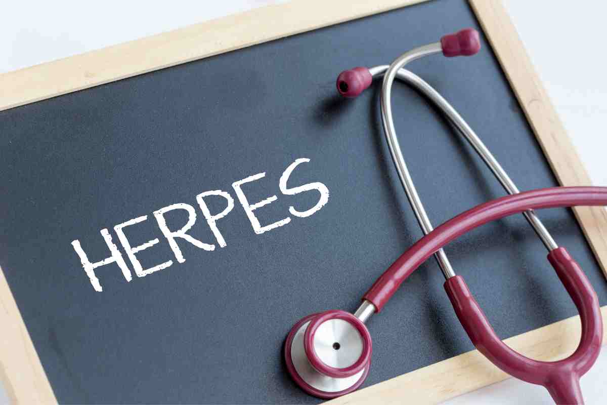I rimedi dell'herpes labiale