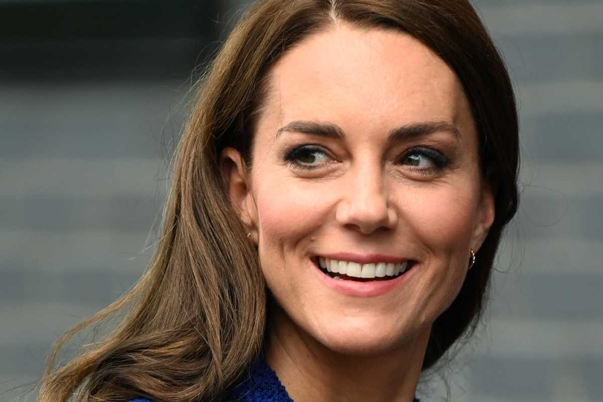Segreto del viso perfetto di Kate Middleton